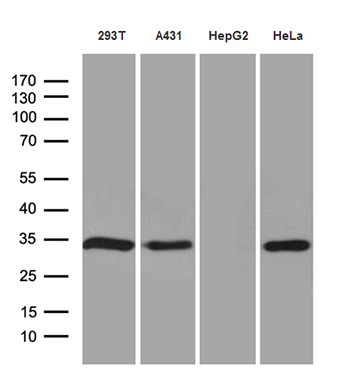 Western blot analysis of extracts (35ug) from 4 different cell lines by using anti-NAT1 monoclonal antibody (1:500)