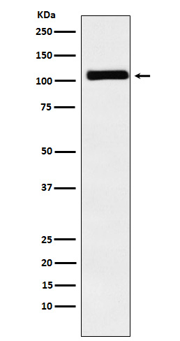 Western blot analysis of MIB1 / DIP1 expression in Caco2 cell lysate