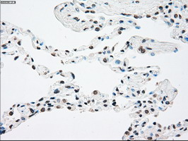 m01388 1 anti trkb ntrk2 mouse monoclonal antibody clone id oti2e1 ihc testing 2