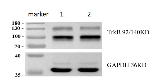  Western blot analysis of TrkB using anti-TrkB antibody (M01388-3)