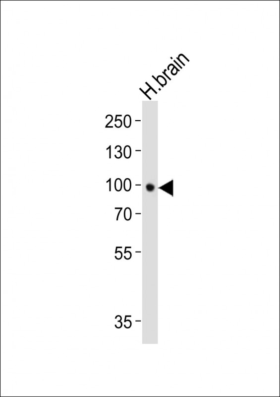 m01388 anti ntrk2 antibody wb testing 1