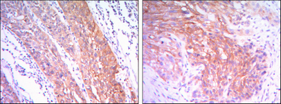 m01389 1 hk2 primary antibodies ihc testing 3