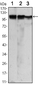 m01389 1 hk2 primary antibodies wb testing 2
