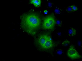 m01389 3 anti hexokinase ii hk2 mouse monoclonal antibody clone id oti4c5 if testing 4