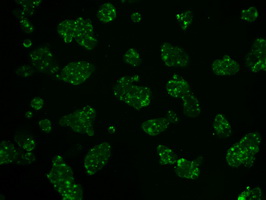 m01389 3 anti hexokinase ii hk2 mouse monoclonal antibody clone id oti4c5 if testing 5