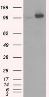 m01389 3 anti hexokinase ii hk2 mouse monoclonal antibody clone id oti4c5 wb testing 1