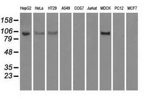 m01389 3 anti hexokinase ii hk2 mouse monoclonal antibody clone id oti4c5 wb testing 2