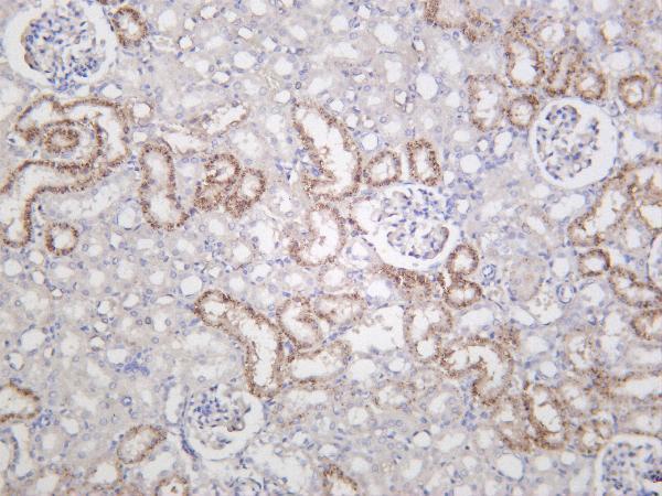 m01389 4 hk2 primary antibodies ihc testing 1