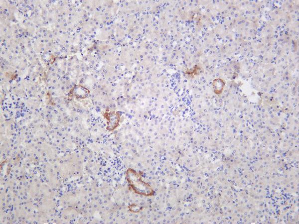m01389 4 hk2 primary antibodies ihc testing 2