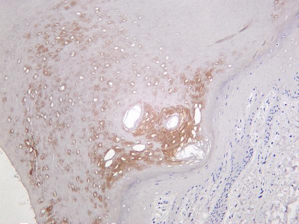 m01389 4 hk2 primary antibodies ihc testing 3