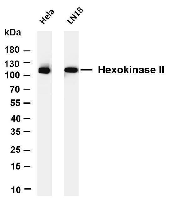 m01389 4 hk2 primary antibodies wb testing 1