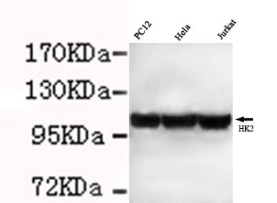 m01389 hk2 primary antiboties wb testing 1
