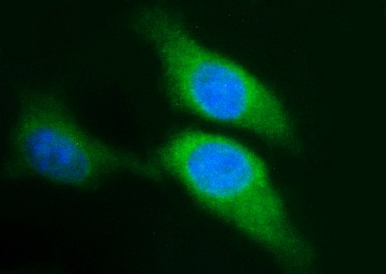 Immunofluorescent staining of HeLa cells using anti-SPHK1 mouse monoclonal antibody (M01390-1)