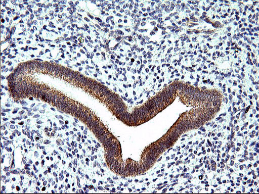 Immunohistochemical staining of paraffin-embedded Human endometrium tissue within the normal limits using anti-SPHK1 mouse monoclonal antibody