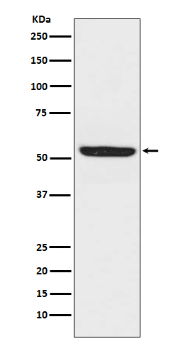 Western blot analysis of SPHK1 expression in Raji cell lysate