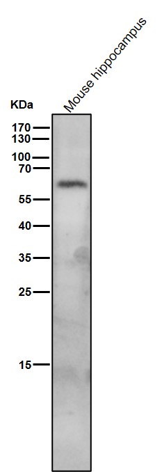 All lanes use the Antibody at 1:1K dilution for 1 hour at room temperature