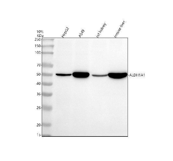 m01392 1 aldh1a1 primary antibodies wb testing 1