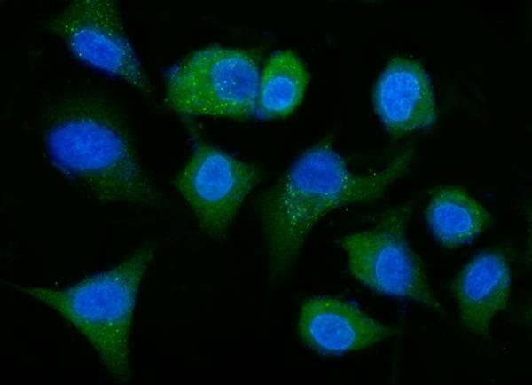 m01392 2 aldh1a1 primary antibodies if testing 4