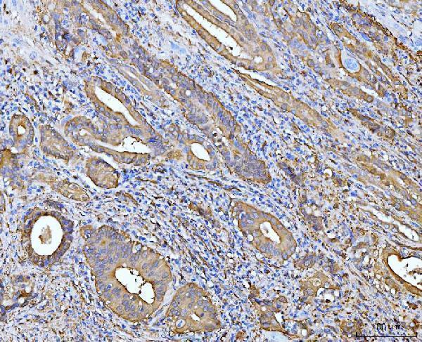 m01392 2 aldh1a1 primary antibodies ihc testing 2