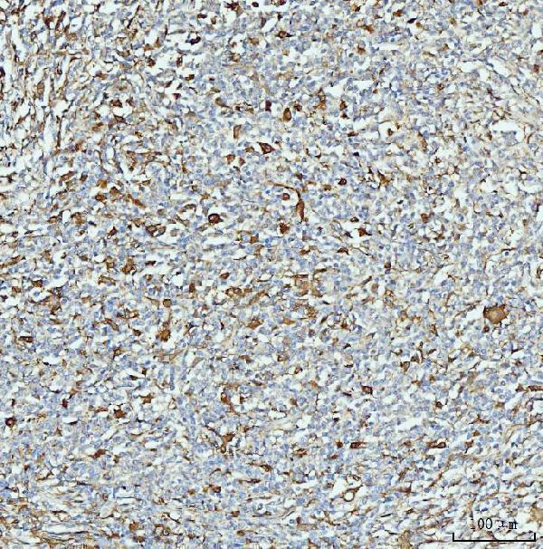 m01392 2 aldh1a1 primary antibodies ihc testing 3