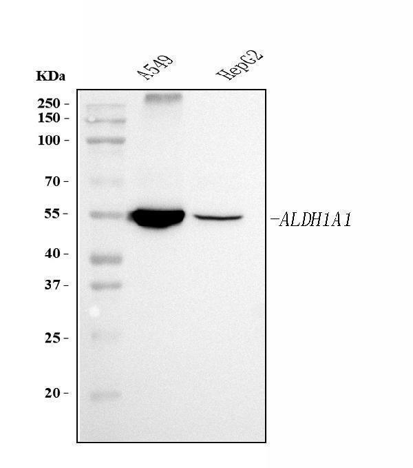 m01392 2 aldh1a1 primary antibodies wb testing 1