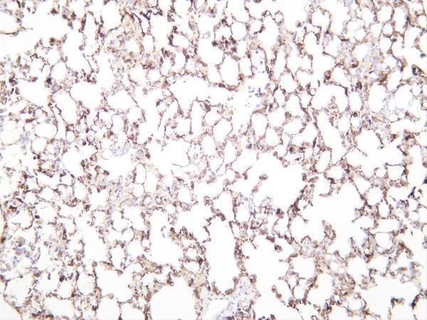 Mouselung was stained with anti-ALDH1A1 rabbit antibody