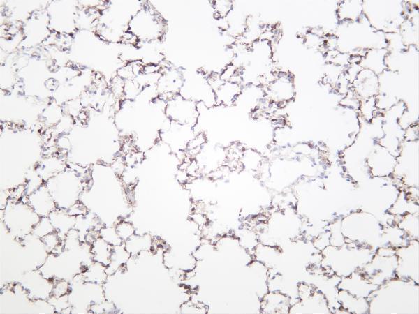 Ratlung was stained with anti-ALDH1A1 rabbit antibody