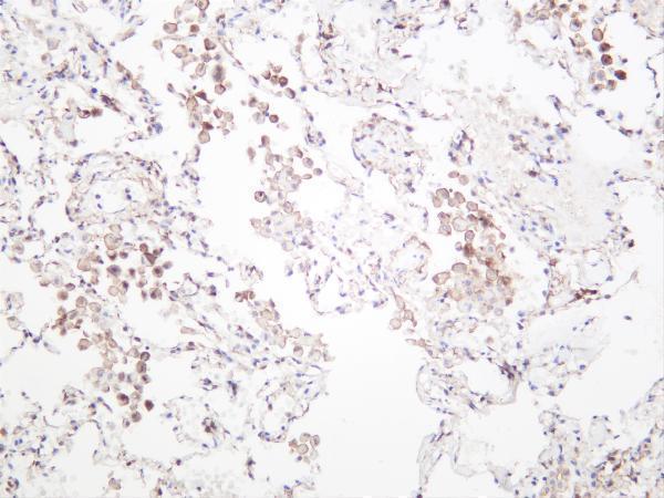 Humanlung was stained with anti-ALDH1A1 rabbit antibody