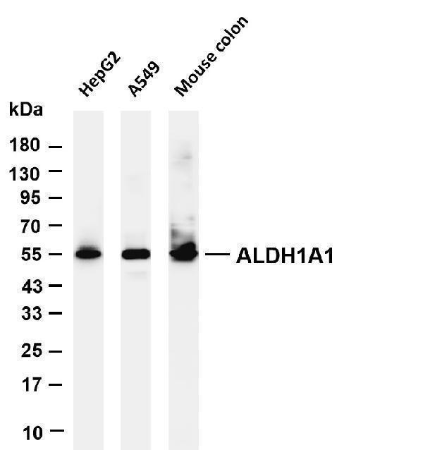m01392 3 aldh1a1 primary antibodies wb testing 1