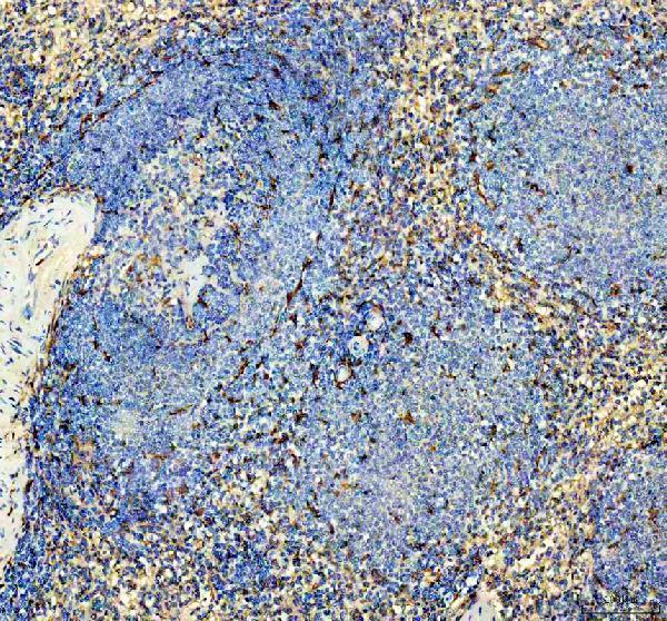 IHC analysis of IBA1/AIF1 using anti-IBA1/AIF1 antibody (M01394-4)