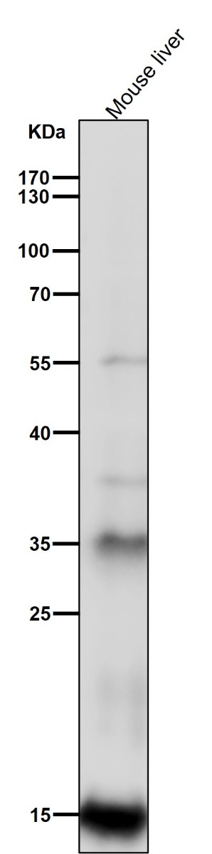 All lanes use the Antibody at 1:2K dilution for 1 hour at room temperature