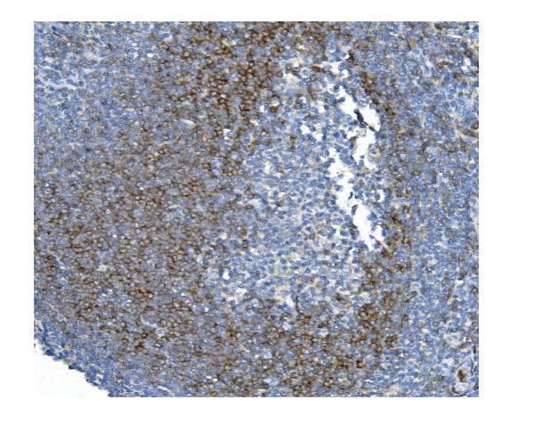  IHC analysis of CD79b using anti-CD79b antibody (M01399-1)