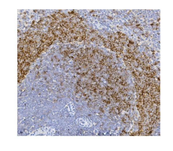  IHC analysis of CD79b using anti-CD79b antibody (M01399-1)