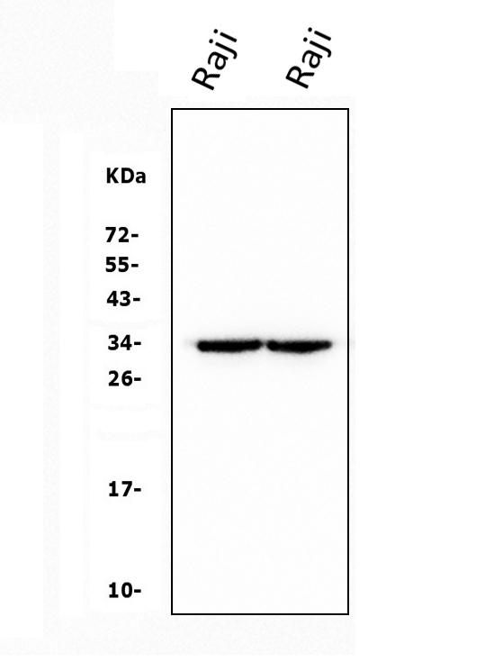  Western blot analysis of CD79b using anti-CD79b antibody (M01399-1)