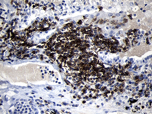 m01399 2 anti cd79b mouse monoclonal antibody clone id oti8a12 ihc testing 4