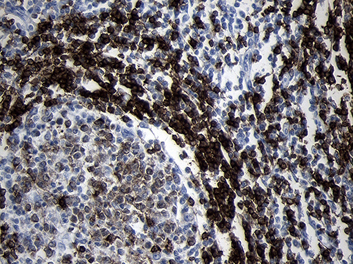m01399 2 anti cd79b mouse monoclonal antibody clone id oti8a12 ihc testing 5