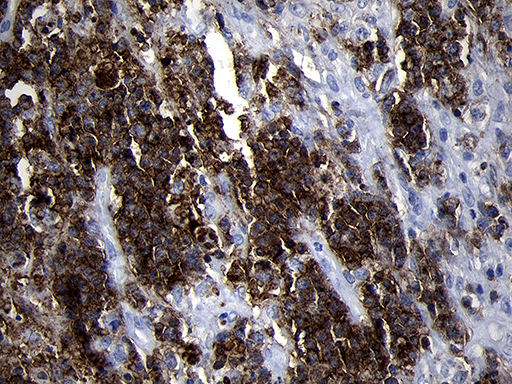 m01399 2 anti cd79b mouse monoclonal antibody clone id oti8a12 ihc testing 6