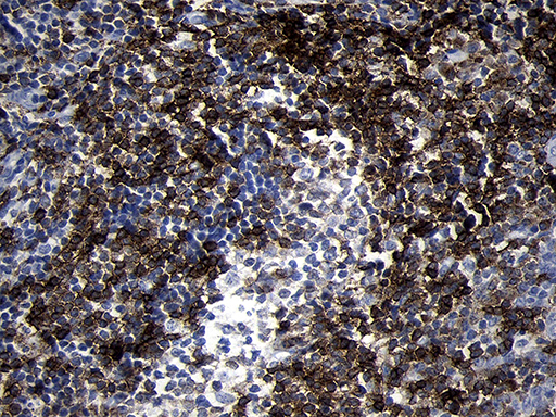 m01399 2 anti cd79b mouse monoclonal antibody clone id oti8a12 ihc testing 7