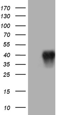 HEK293T cells were transfected with the pCMV6-ENTRY control (Left lane) or pCMV6-ENTRY CD79B (Right lane) cDNA for 48 hrs and lysed