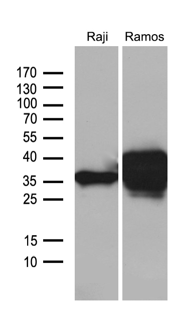 Western blot analysis of extracts (35ug) from 2 different cell lines by using anti-CD79B monoclonal antibody (1:500)