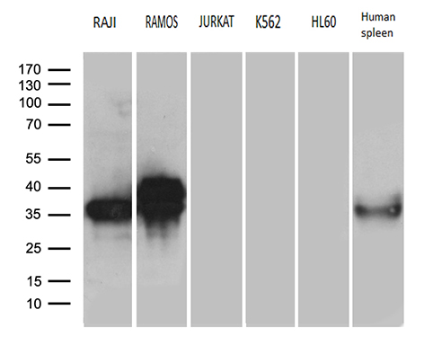 Western blot analysis of extracts (35ug) from 5 different cell lines and human spleen tissue lysate by using anti-CD79A monoclonal antibody (1:500)