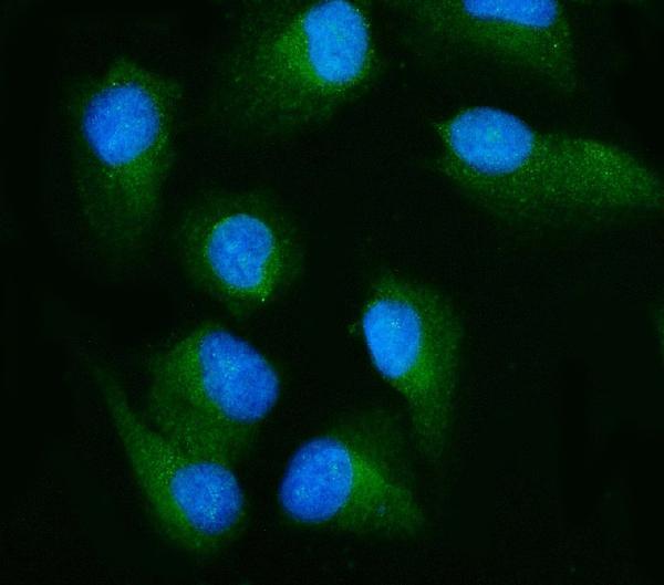m01403 4 ralbp1 primary antibodies if testing 7