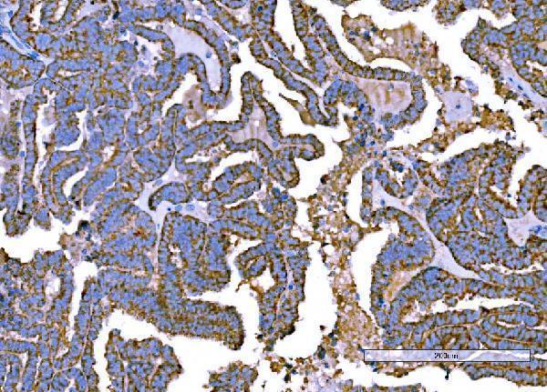  IHC analysis of RALBP1 using anti-RALBP1 antibody (M01403-4)
