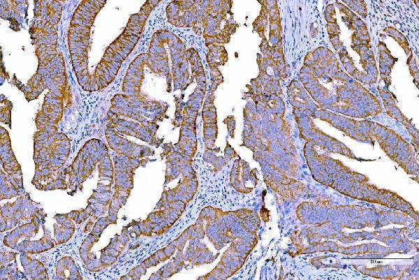  IHC analysis of RALBP1 using anti-RALBP1 antibody (M01403-4)