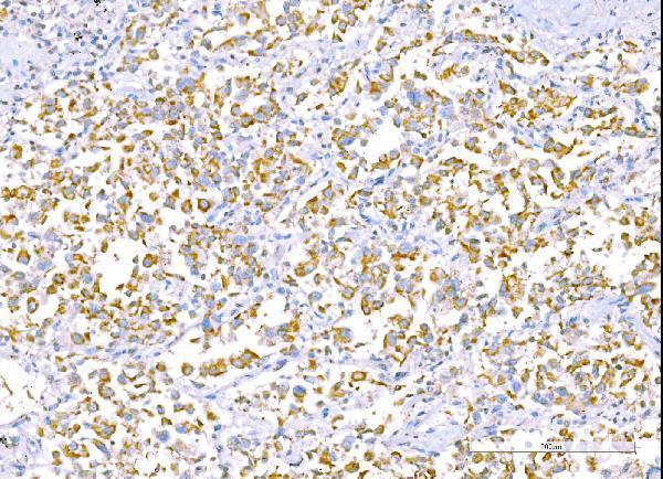 m01403 4 ralbp1 primary antibodies ihc testing 4