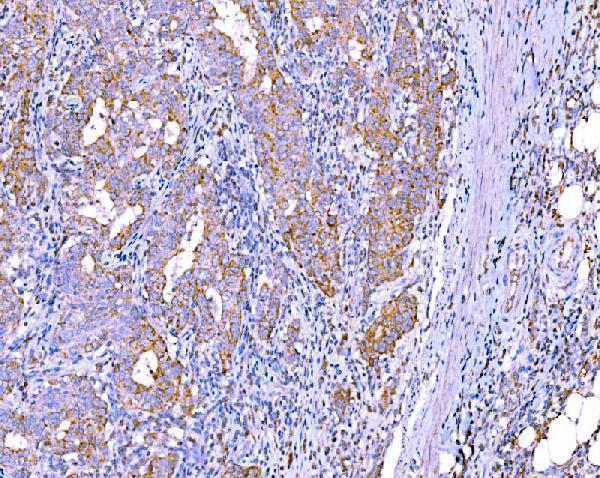 m01403 4 ralbp1 primary antibodies ihc testing 5