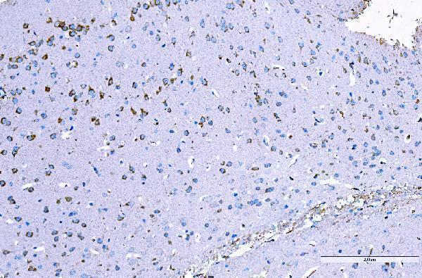 m01403 4 ralbp1 primary antibodies ihc testing 6