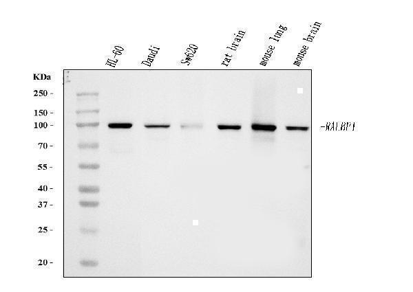  Western blot analysis of RALBP1 using anti-RALBP1 antibody (M01403-4)