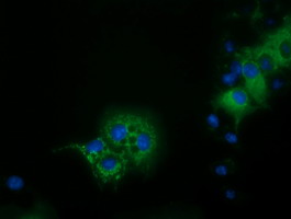 m01404 1 anti ivd mouse monoclonal antibody clone id oti1b10 if testing 12