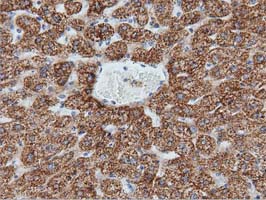 m01404 1 anti ivd mouse monoclonal antibody clone id oti1b10 ihc testing 11